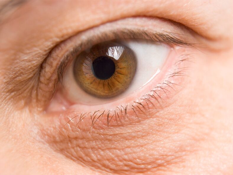 Skin around the eyes and laser rejuvenation