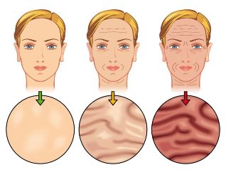 stage of ageing of the skin